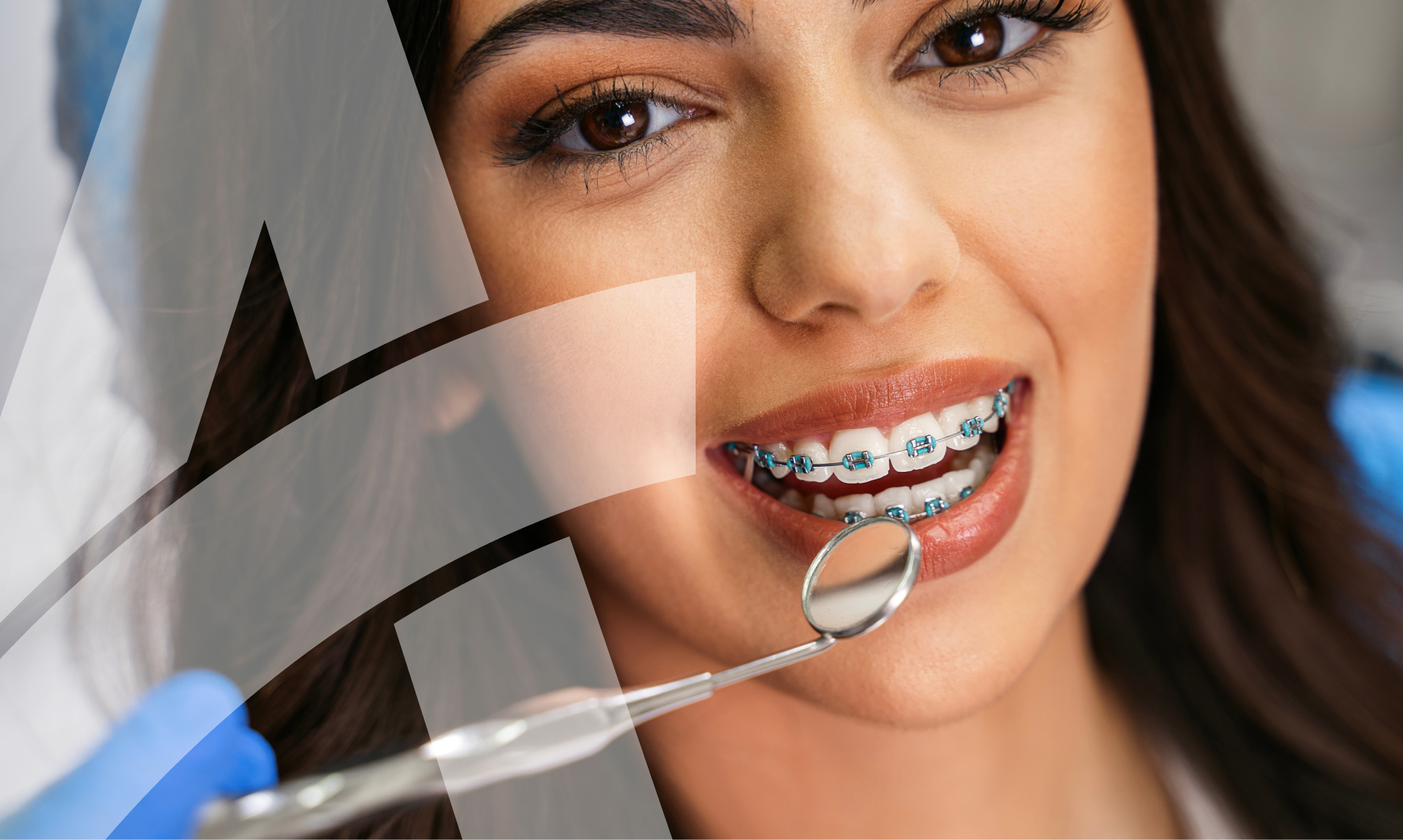 Affordable Dental Insurance For Family Of Four With Orthodontic Coverage